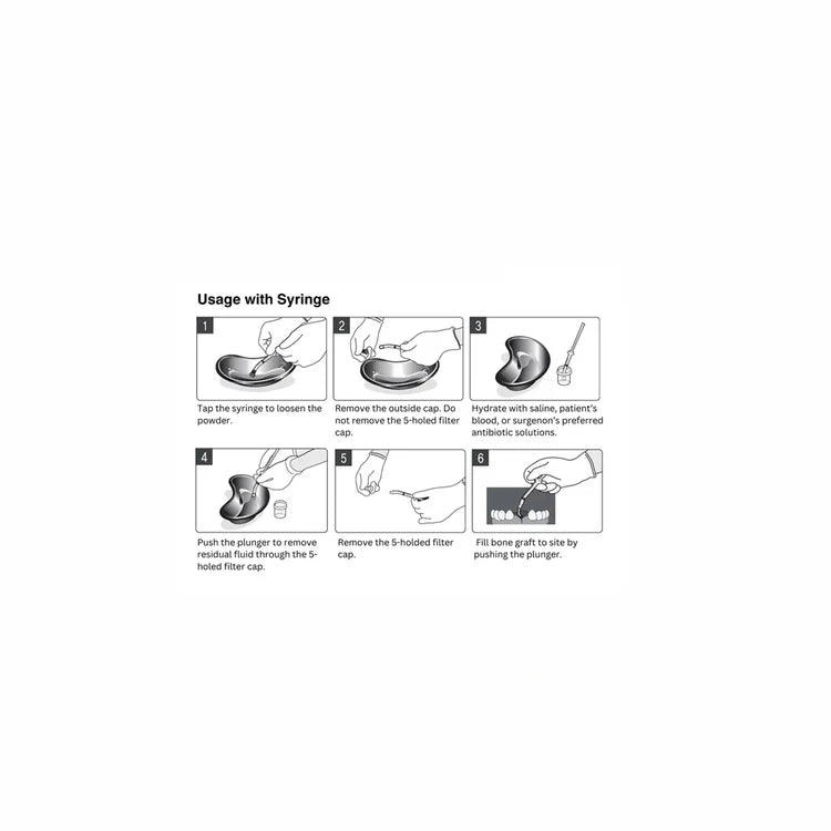OsseoSeal Mineralized Cortico-Cancellous Bone in Syringe / 1cc : 2x0.5cc